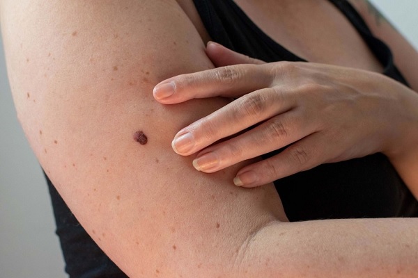 5 tín hiệu cảnh báo ung thư ở người trung niên, người già